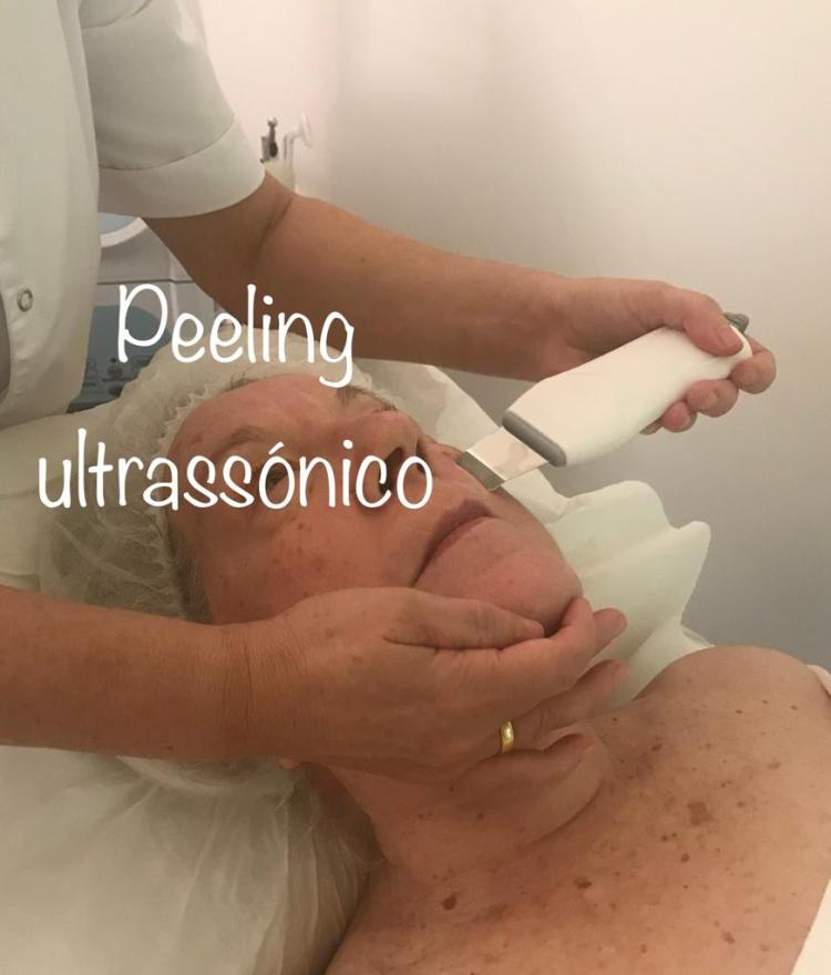 Peeling ultrassónico na clínica de medicina alternativa